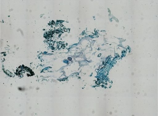 Pherusella