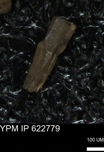 undet. Echinoidea