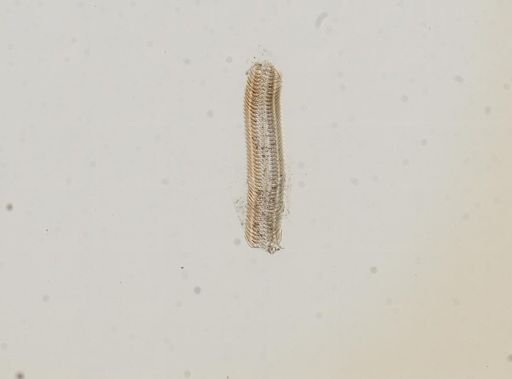 Somatogyrus subglobosus