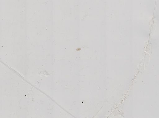 Paramecium