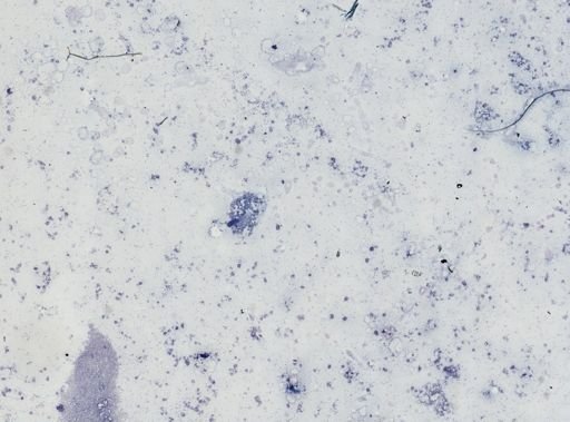 Leishmania donovani