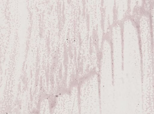 Plasmodium vivax