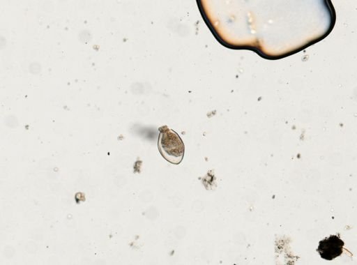 Fasciolopsis buski