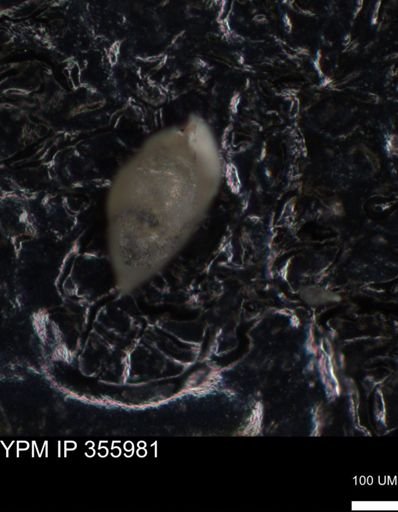 undet. Foraminiferida