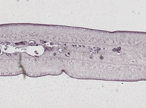 Taenia saginata
