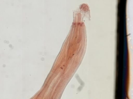 Oligacanthorhynchus microcephalus