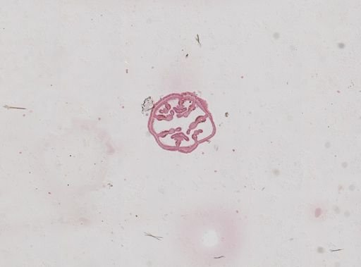 Nematostella