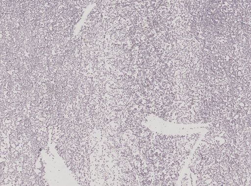 Plasmodium elongatum