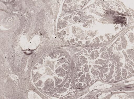 Eimeria stiedae
