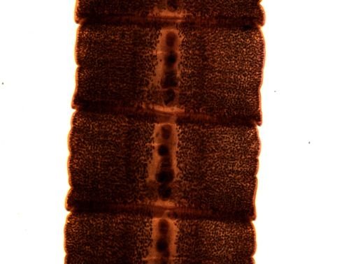 Diphyllobothrium erinacei