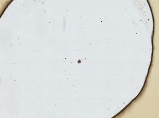 Lecane ligona