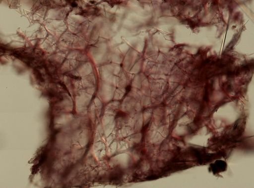 Callyspongia vaginalis
