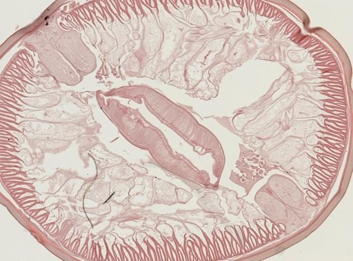 Ascaris lumbricoides