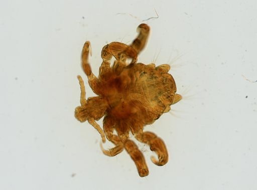 Pthirus pubis