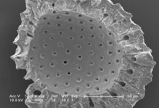 Globigerinoides ruber