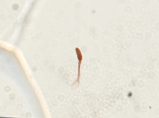 Schistosoma mansoni