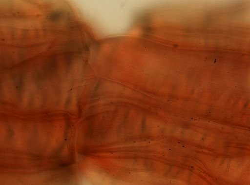 Taenia saginata