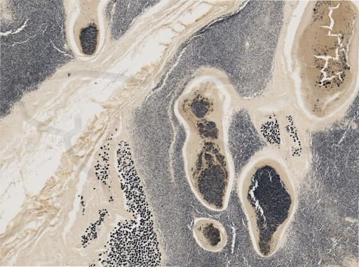 Pleistophora macrozoarcides