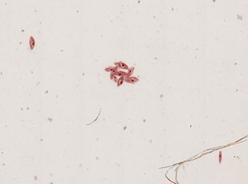 Paramecium