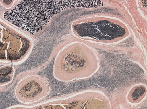 Ichthyosporidium