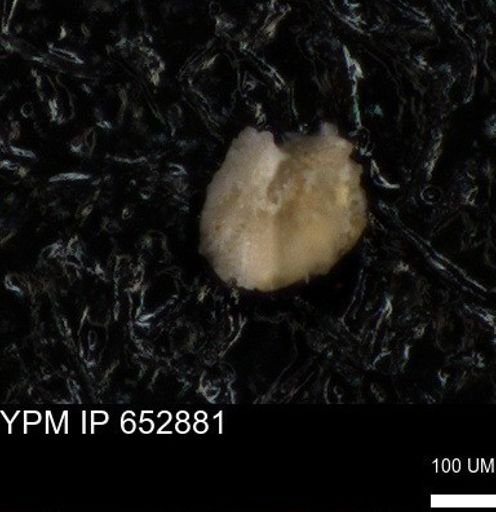 undet. Foraminiferida
