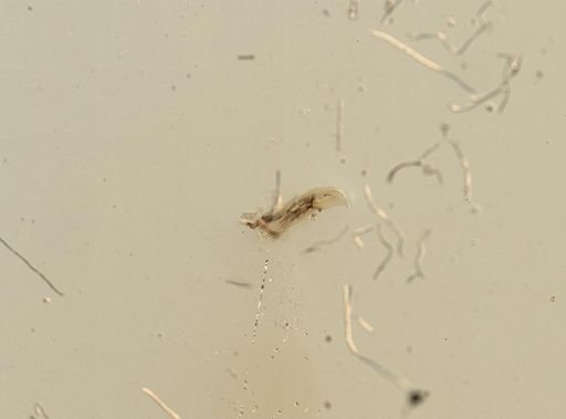 Hydrobia ulvae