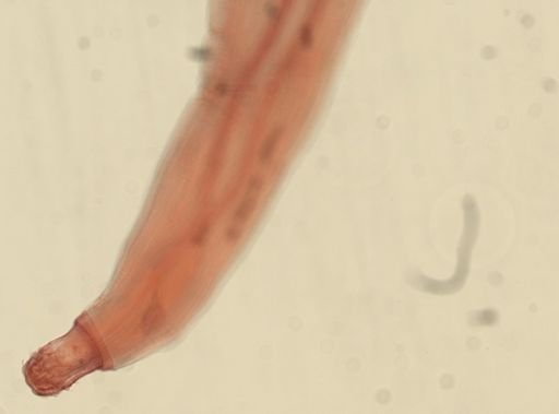 Oligacanthorhynchus microcephalus