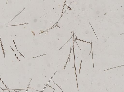 Ecionemia walkeri