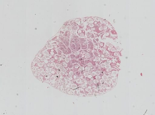 Lumbricidae