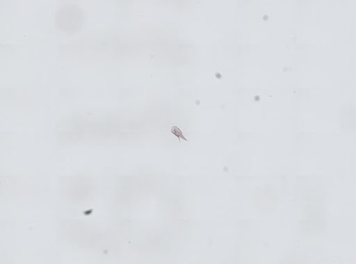 Hyalella cf. azteca