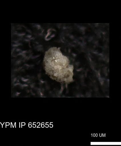 undet. Foraminiferida