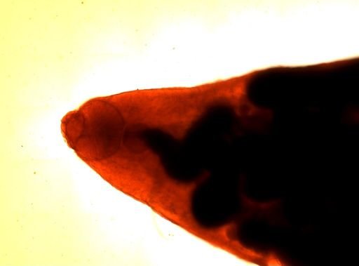 Haematoloechus longiplexus
