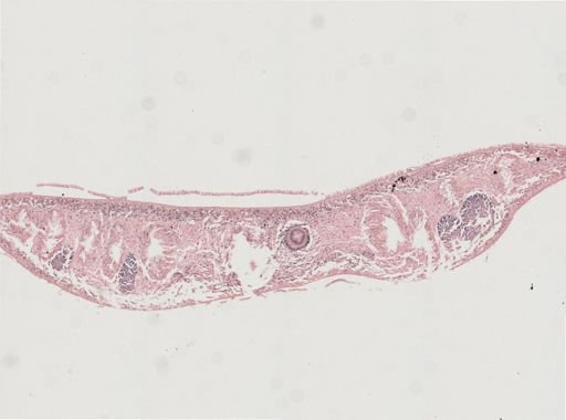 Phagocata gracilis
