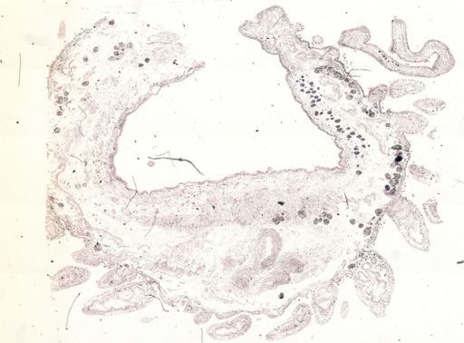 Thysanozoon brocchii