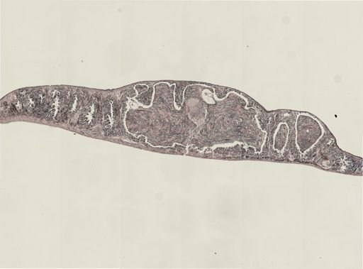Foviella