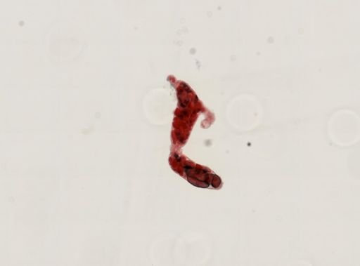 Trematoda