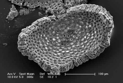 Orbulina universa