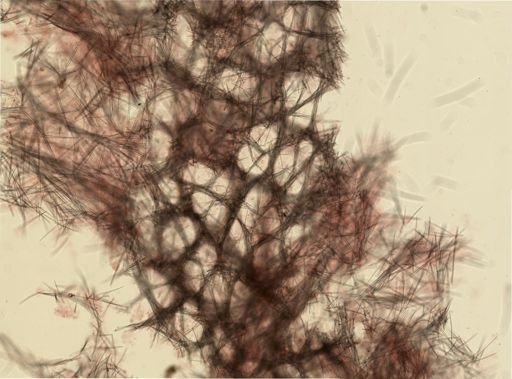 Halichondria panicea