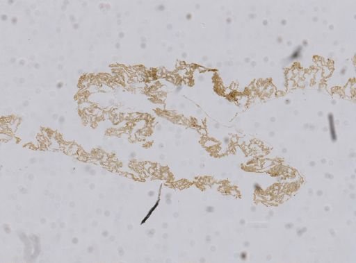 Goreauiella auriculata