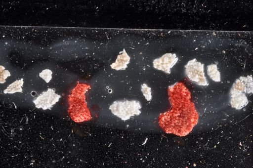 Bryozoa