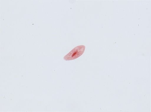 Paramecium