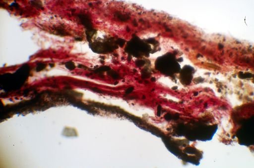 Ircinia strobilina