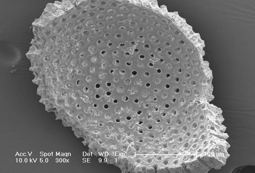 Globigerinoides ruber