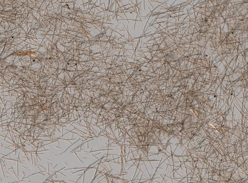 Neofibularia nolitangere