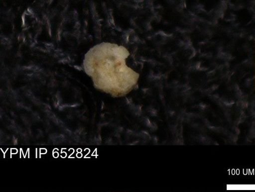 undet. Foraminiferida