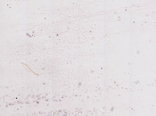 Trypanosoma lewisi