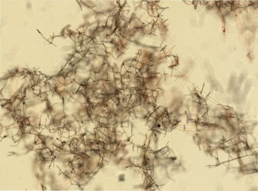 Haliclona oculata