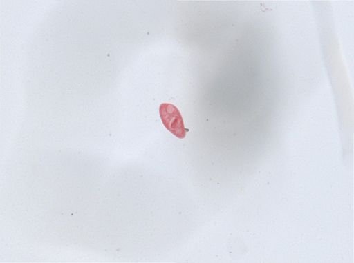 Paramecium aurelia