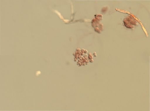Branchiostoma