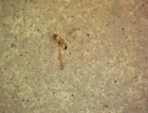 undet. Hexapoda